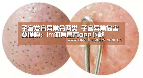 im体育下载